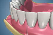 OHI Floss Standard